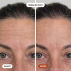 DermaÉclat
