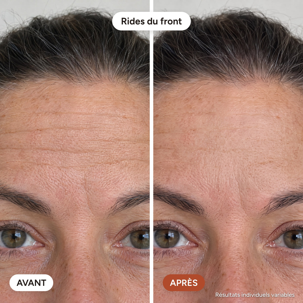 DermaÉclat