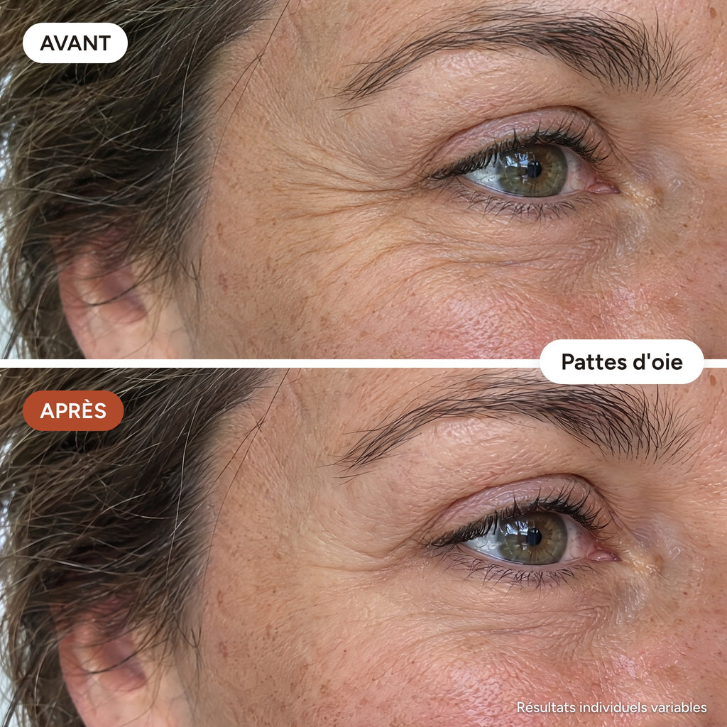 DermaÉclat