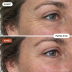DermaÉclat