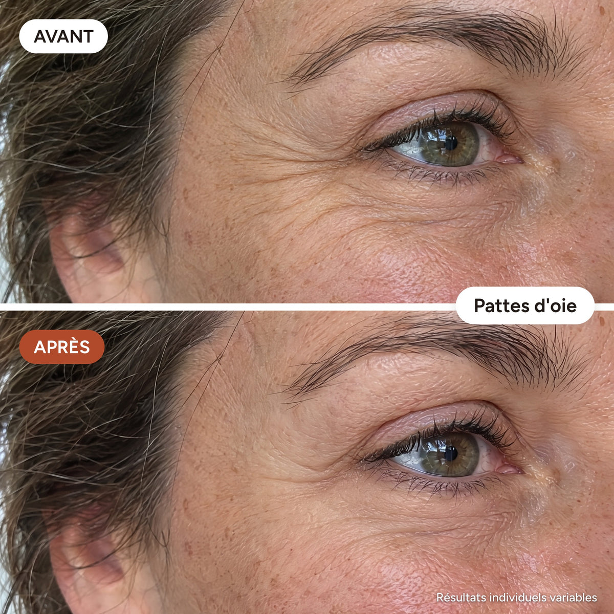 DermaÉclat