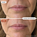DermaÉclat