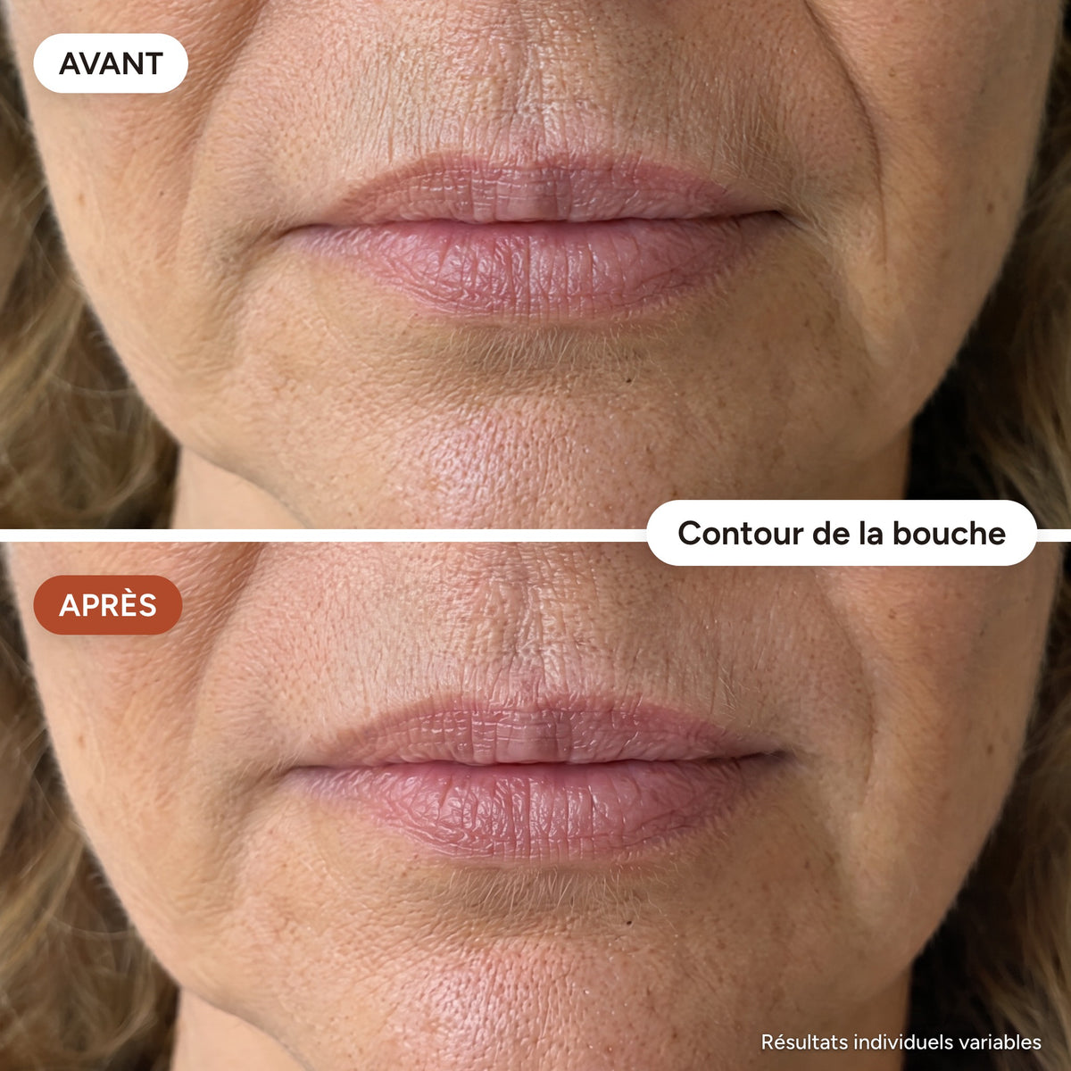 DermaÉclat